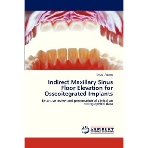 Indirect Maxillary Sinus Floor Elevation for Osseoitegrated Implants Paperback, LAP Lambert Academic Publishing