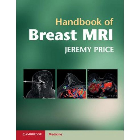 Handbook of Breast MRI Paperback, Cambridge University Press