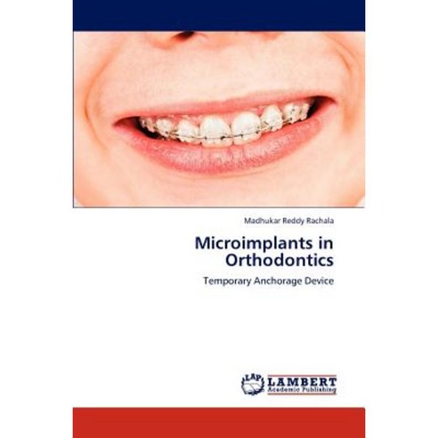 Microimplants in Orthodontics Paperback, LAP Lambert Academic Publishing