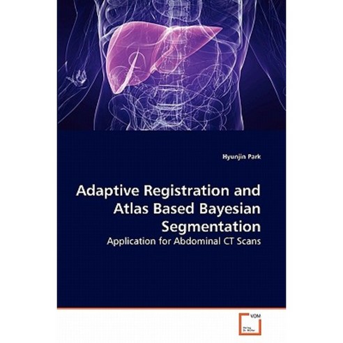 Adaptive Registration and Atlas Based Bayesian Segmentation Paperback, VDM Verlag