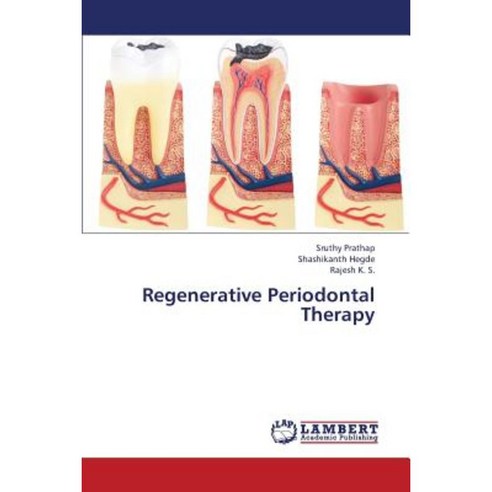 Regenerative Periodontal Therapy Paperback, LAP Lambert Academic Publishing