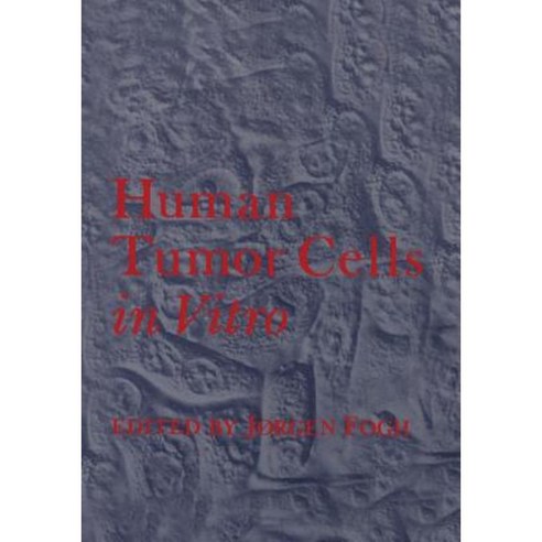 Human Tumor Cells in Vitro Paperback, Springer
