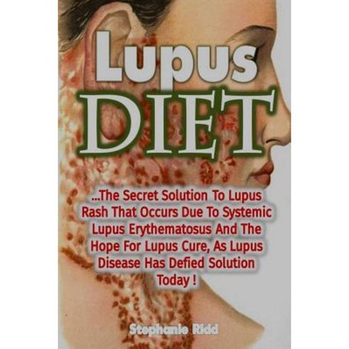 Lupus Diet: The Secret Solution to Lupus Rash That Occurs Due to Systemic Lupus Paperback, Createspace Independent Publishing Platform