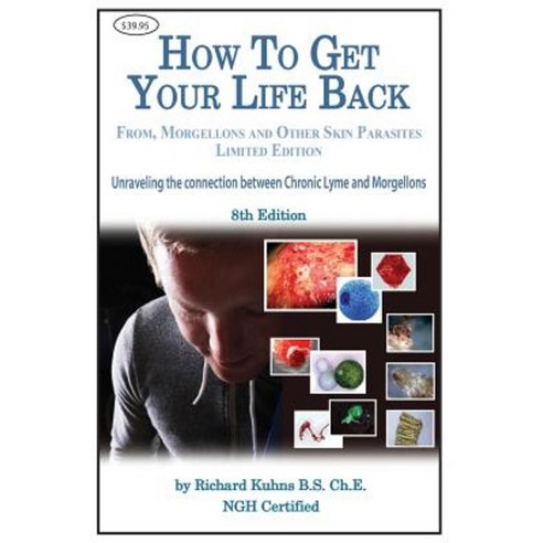 How to Get Your Life Back from Morgellons and Other Skin Parasites Limited Edit Paperback, Createspace Independent Publishing Platform