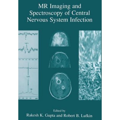 MR Imaging and Spectroscopy of Central Nervous System Infection Paperback - 생명과학 일반 | 쿠팡