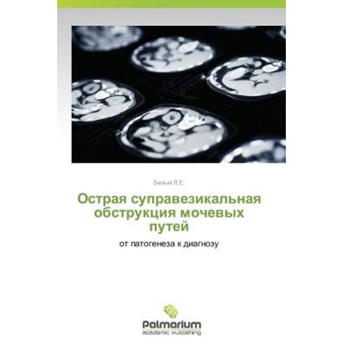 Ostraya Supravezikal''naya Obstruktsiya Mochevykh Putey Paperback, Palmarium Academic Publishing