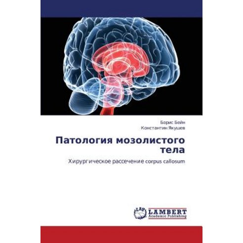 Patologiya Mozolistogo Tela Paperback, LAP Lambert Academic Publishing