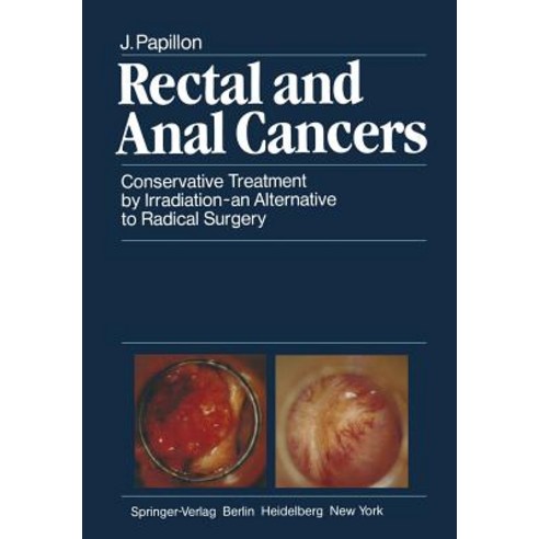 Rectal and Anal Cancers: Conservative Treatment by Irradiation -- An Alternative to Radical Surgery Paperback, Springer