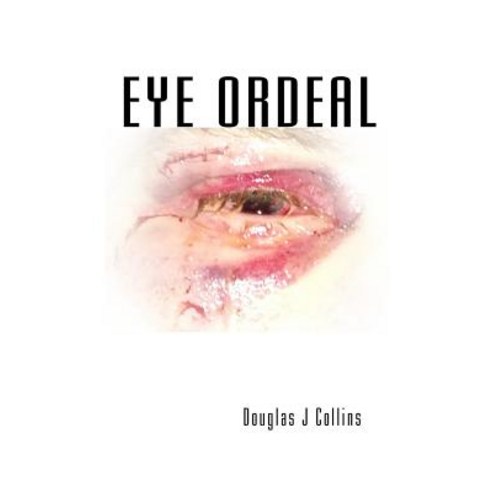 Eye Ordeal Paperback, Createspace Independent Publishing Platform