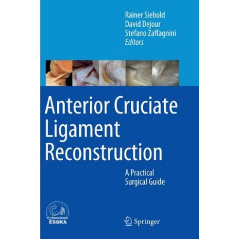 Anterior Cruciate Ligament Reconstruction: A Practical Surgical Guide Hardcover, Springer