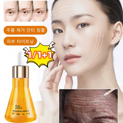 자일렌프리