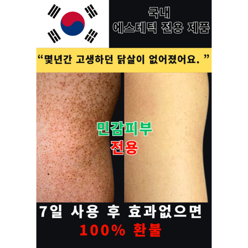 [효과없음 100% 환불] 닥클 청소년 전용 팔모공각화증 등드름 가드름 미스트 닭살피부