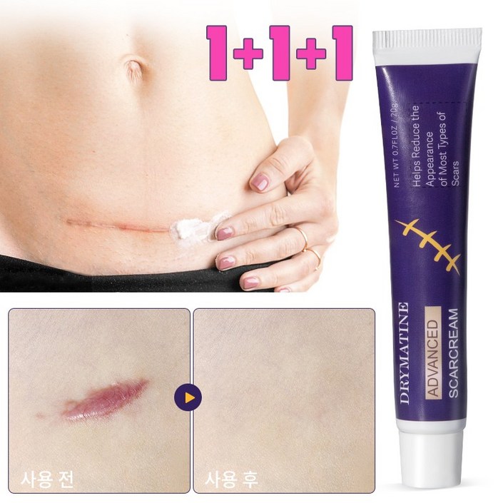 당일배송 DRYMATINE 흉터연고 흉터제거연고 재생크림 상처흉터연고 여드름흉터 수술흉터 화상물집 흉터제거연고, 3개, 20ml