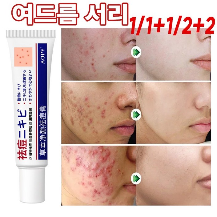 여드름 연고 피지 케어 구덩이 자국 복구