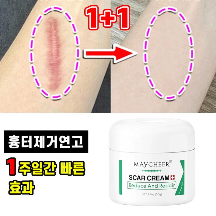 빠른배송 11 흉터 제거 연고 수술 상처 화상 피부 흉터 크림 제왕절개 흉터 관리 포장증정