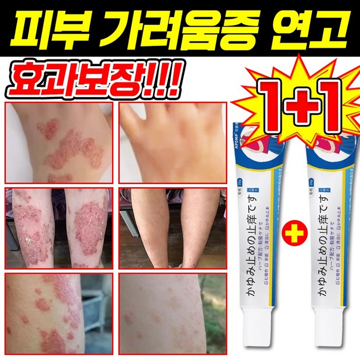 일본 기술 1122 피부 가려움증 연고 건선 연고 치료제 습진 모낭염 연고 지루성 피부염 각종 피부 트러블 곰팡이균 볽은반점 완화 크림