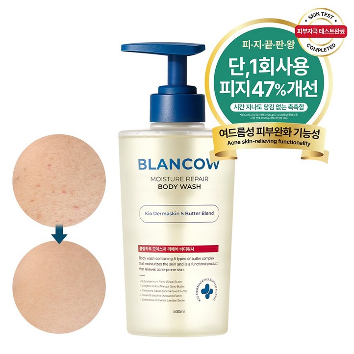 국내 유일 1회사용 피지 47개선 BHA 여드름기능성 바디워시 모공각화증 각질개선 문제성피부 즉각보습, 1개, 500ml 국내 유일 1회사용 피지 47개선 BHA 여드름기능성 바디워시 모공각화증 각질개선 문제성피부 즉각보습, 1개, 500ml
