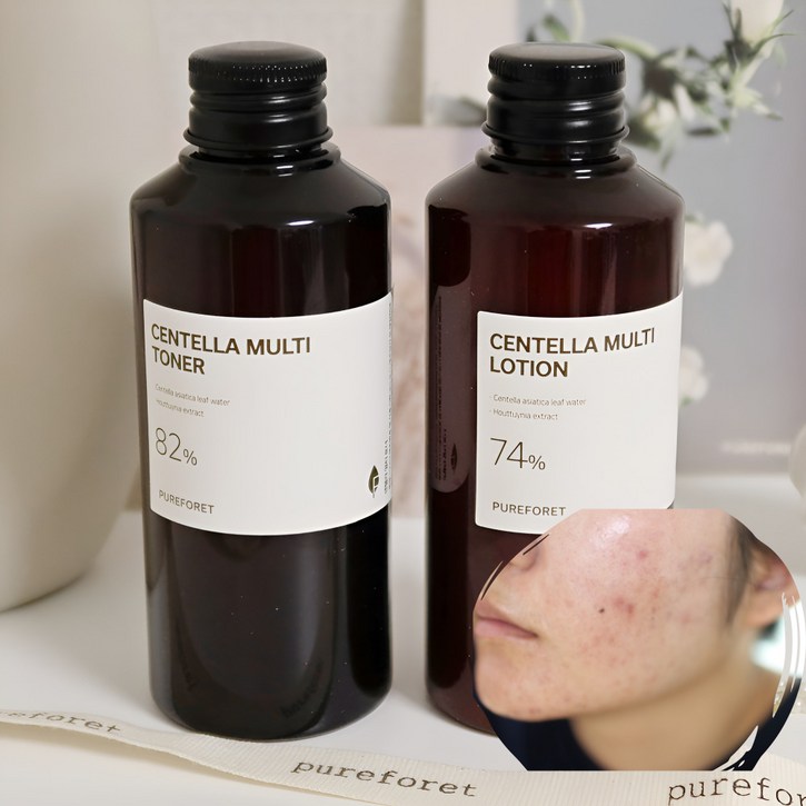 청소년 사춘기 여드름 화장품 스킨 로션 2종 기초세트 100%식물성 병풀추출물